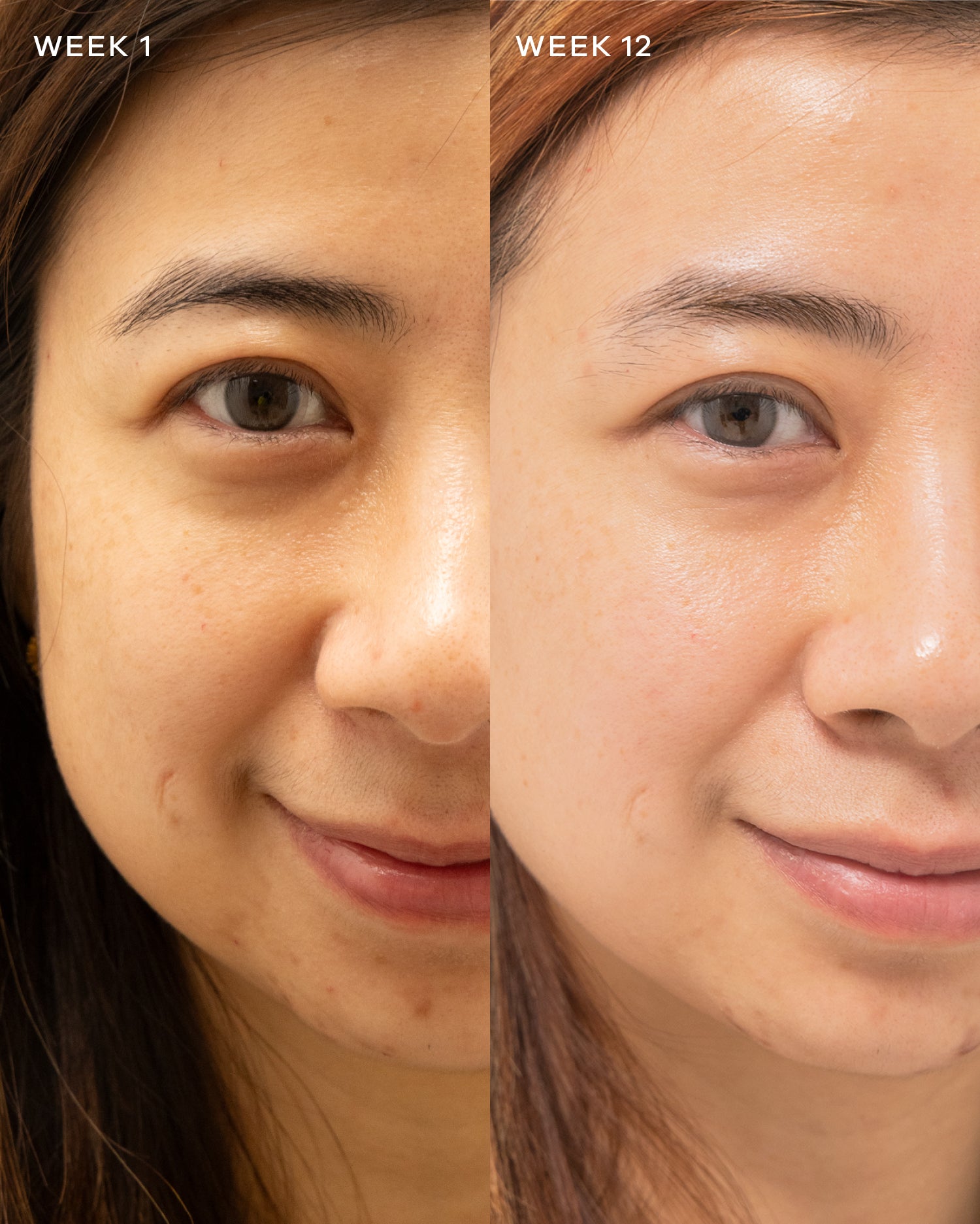 Collagen Liquid Advance- Mixed Berries